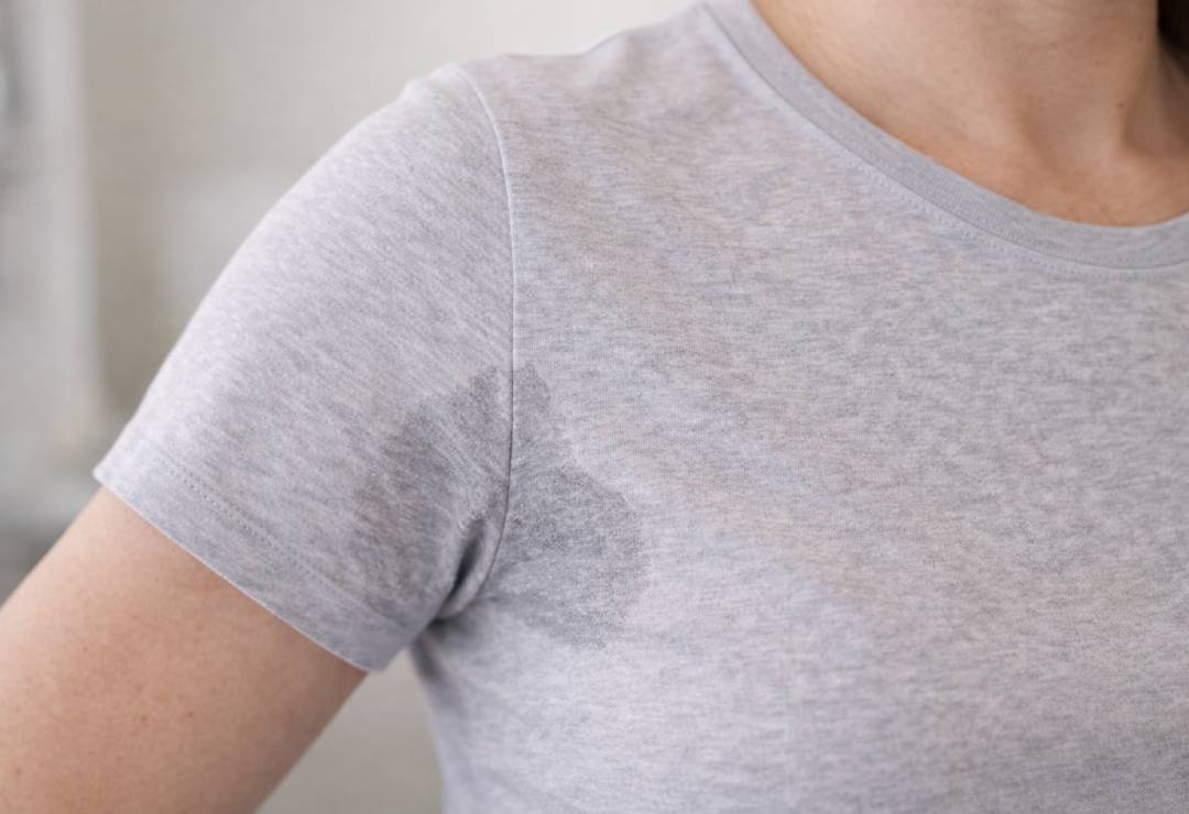 Aşırı Terleme Tedavisi