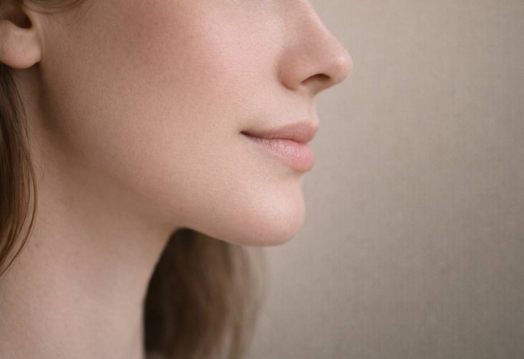 Ameliyatsız Çene Estetiği