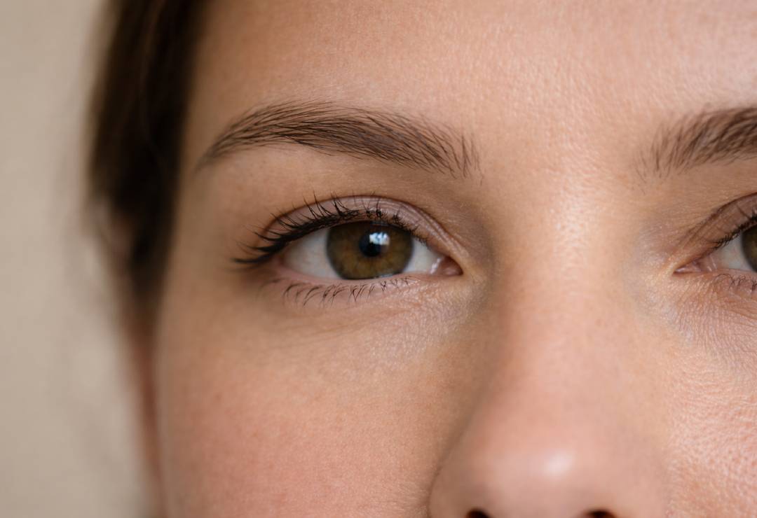 Ameliyatsız Göz Kapağı Estetiği